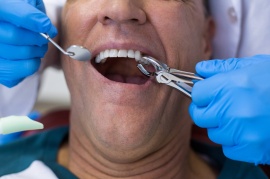 Как предупредить вирусный гепатит в стоматологии